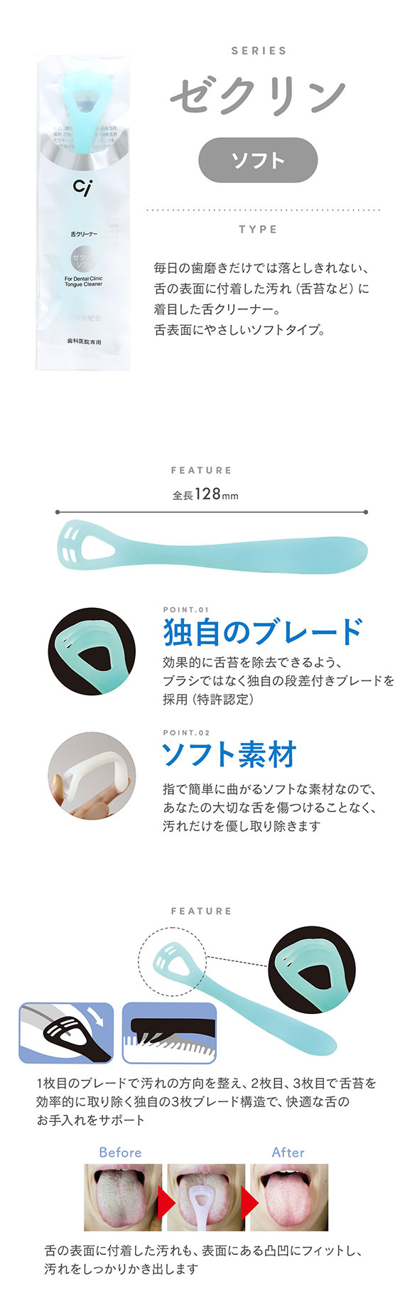 ゼクリン ソフト 舌クリーナー アソート 4本入 口臭予防 日本製